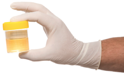 Gloved hand holding urine sample cup